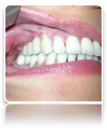 collage image title
