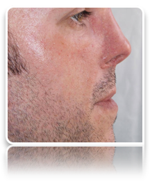 collage image title