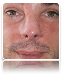 collage image title