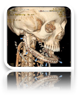 collage image title