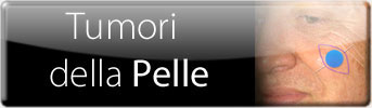 Tumori della Pelle